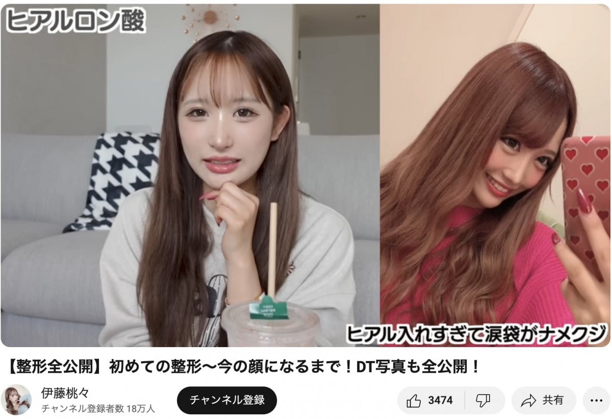 整形公表美女たちのビフォーアフター　総額いくら？　どこを変えたの？　赤裸々告白