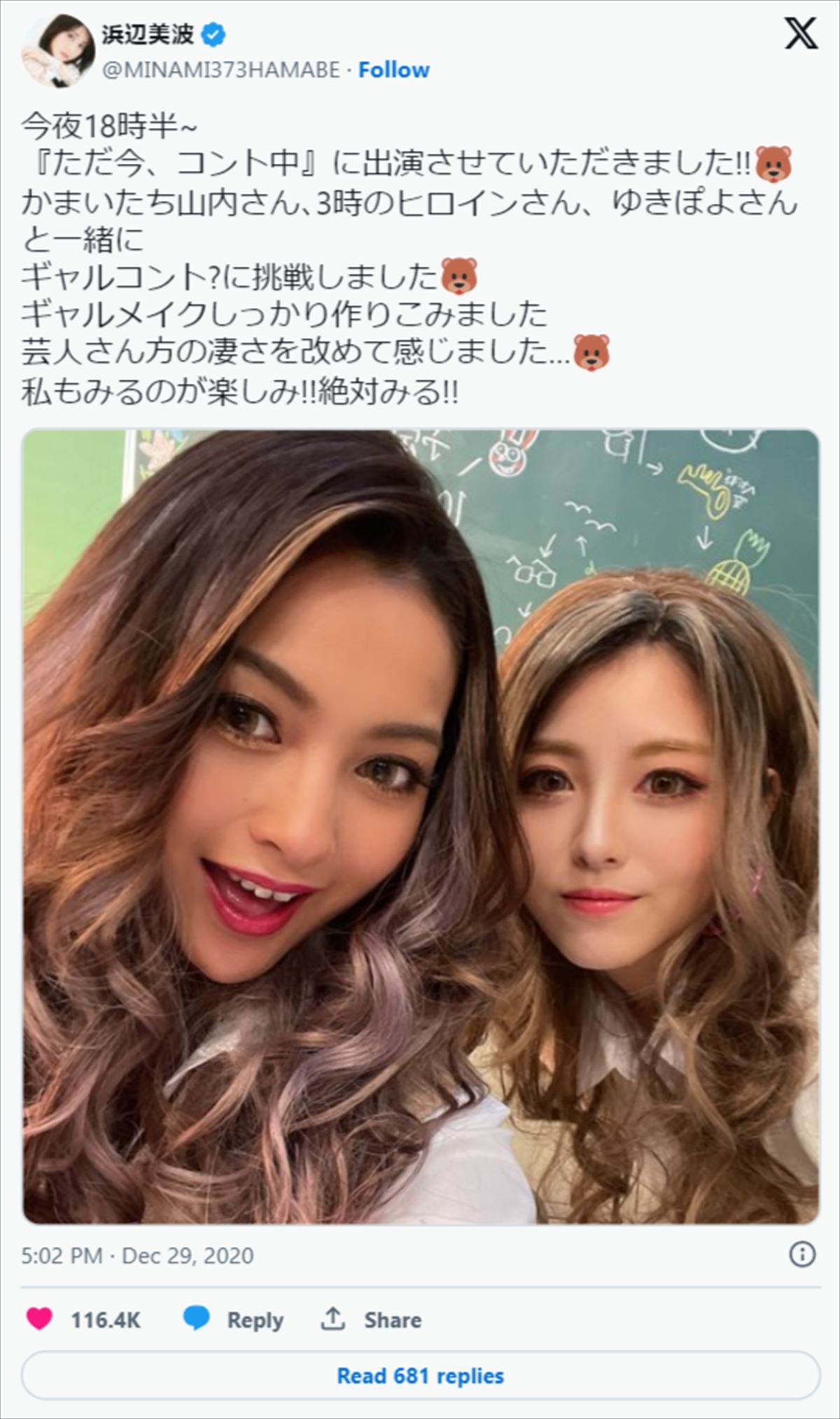 浜辺美波、本日24歳に！　ギャルメイクにツインテール制服姿まで　可愛すぎる激レアショットまとめ