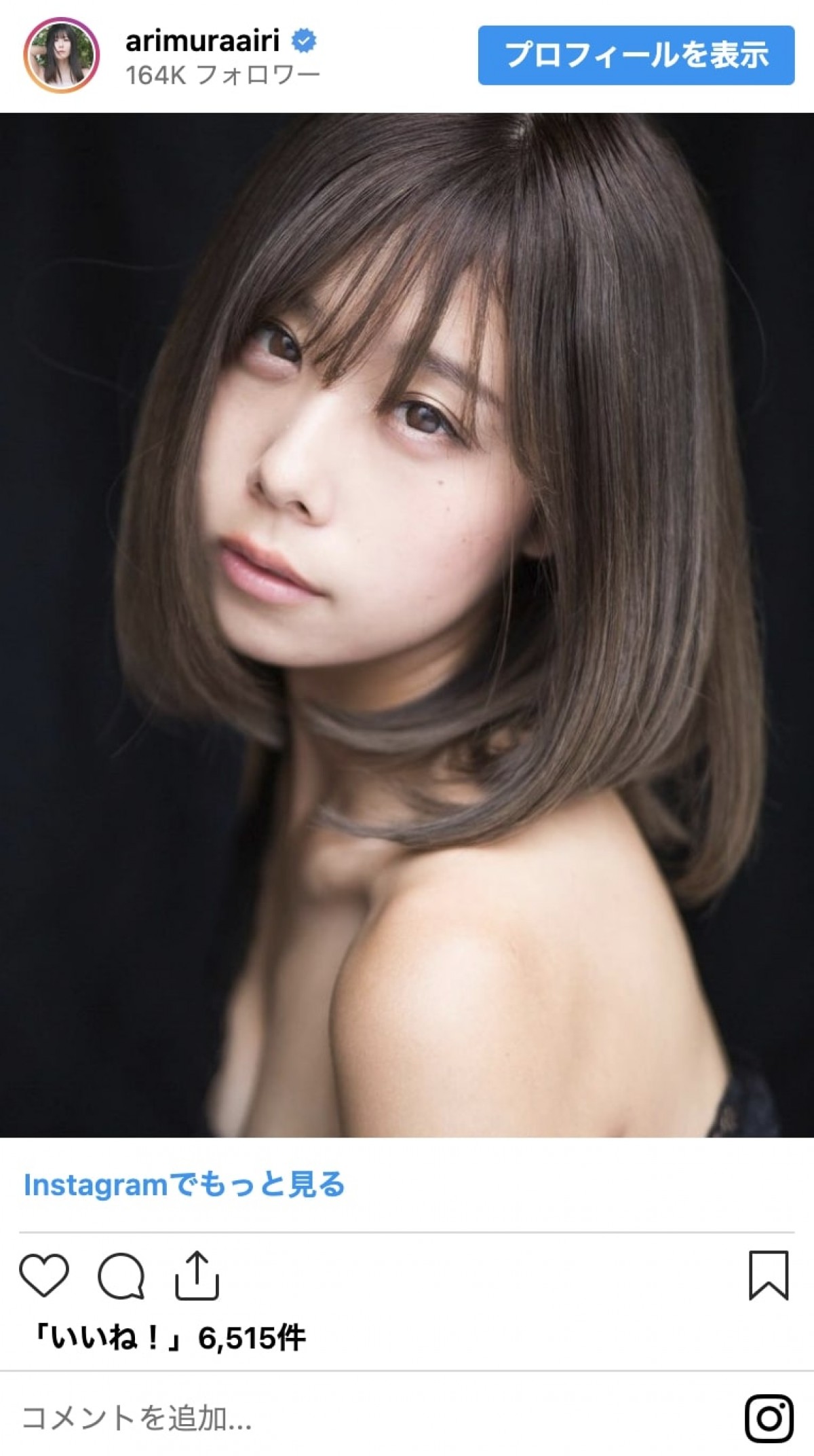 整形公表美女たちのビフォーアフター　総額いくら？　どこを変えたの？　赤裸々告白