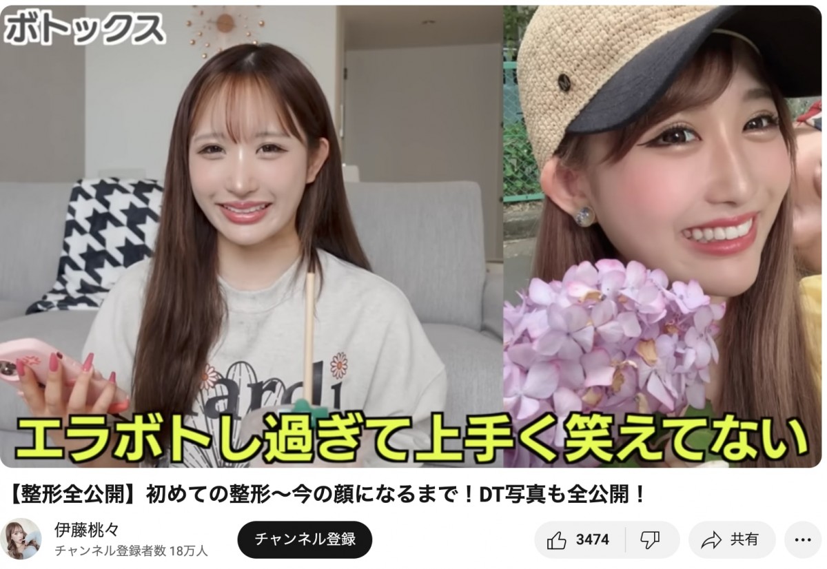 整形公表美女たちのビフォーアフター　総額いくら？　どこを変えたの？　赤裸々告白