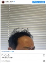 ハート型に見えなくもない…？　アンガールズ田中の寝ぐせ　※「田中卓志（アンガールズ）」インスタグラム