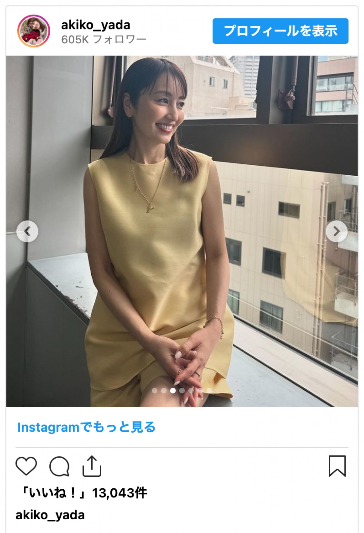 矢田亜希子、夏らしい爽やかコーデの美脚に絶賛集まる「脚が綺麗」「生脚サイコー」