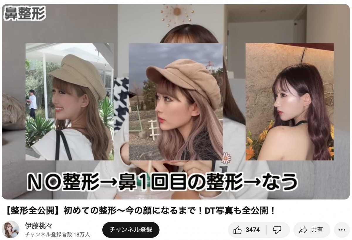整形公表美女たちのビフォーアフター　総額いくら？　どこを変えたの？　赤裸々告白