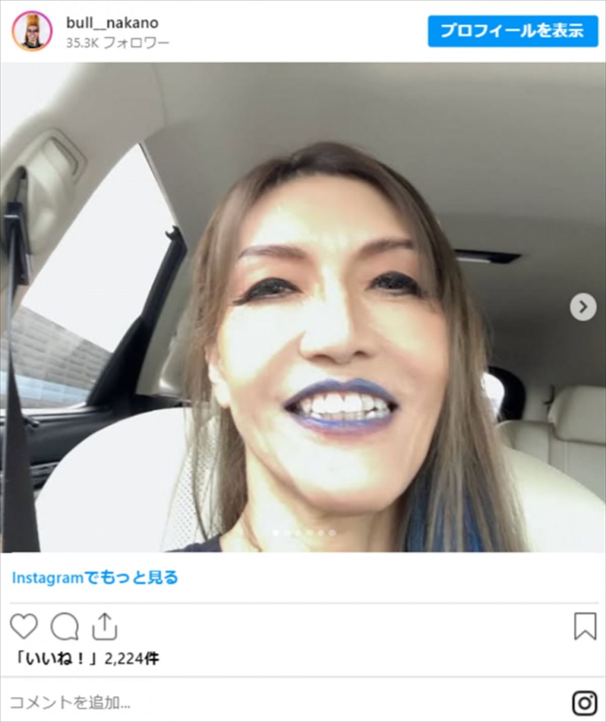“激痩せ”姿が衝撃の芸能人【5選】　ビフォーアフターが“別人級”　驚異の50kg減量も