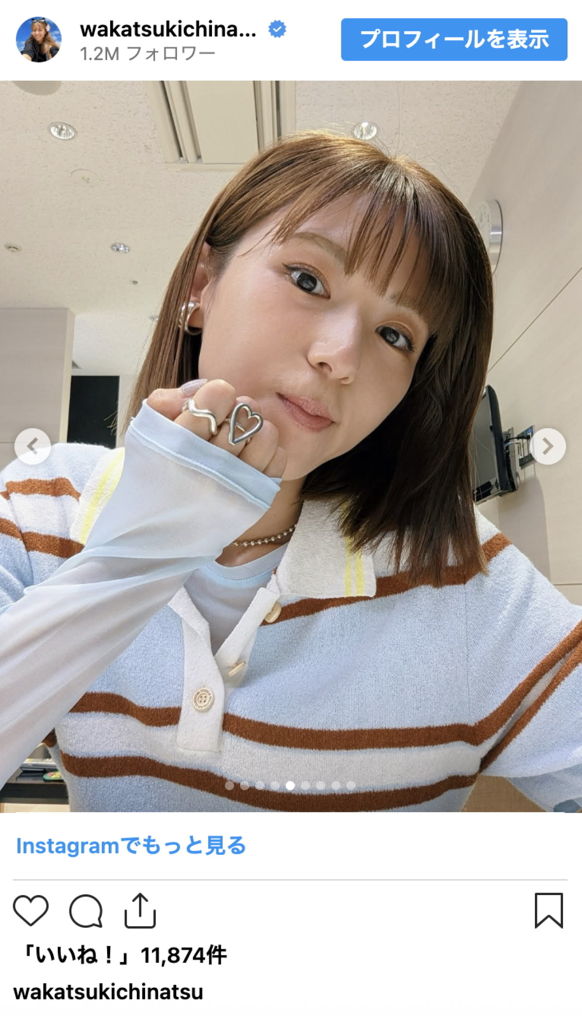 若槻千夏40歳、リップはChatGPTで選定　変わらぬ美貌に「いつ見ても若い」「可愛すぎ」