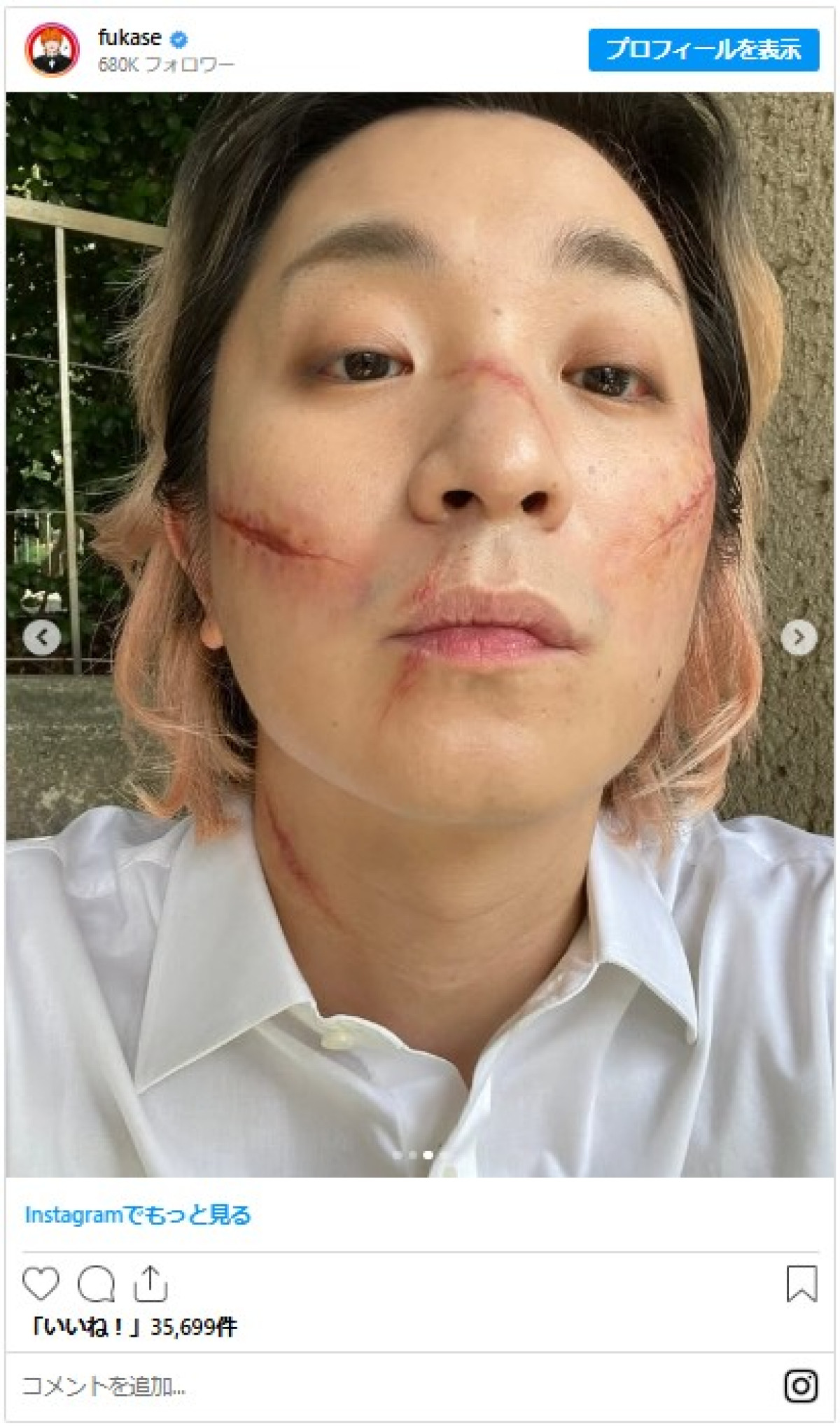 人気バンドボーカル、突如“血まみれ”姿を公開でファン驚き「サイコパス感」「たまんねえ」