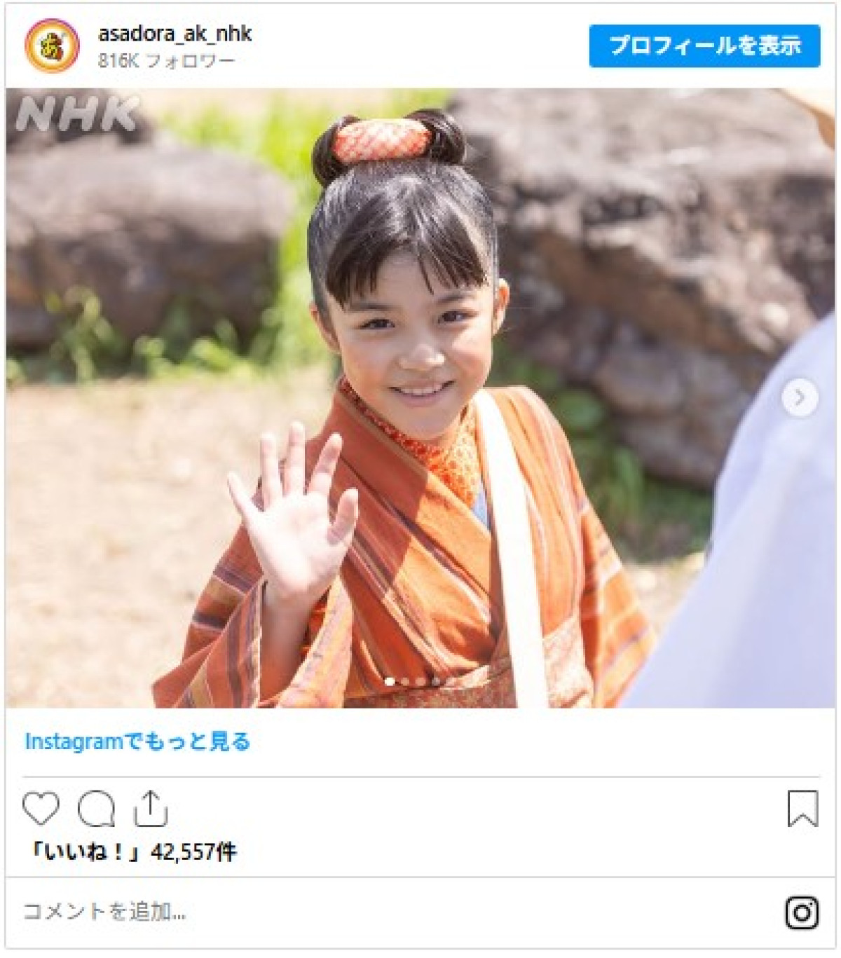 『あんぱん』“激変”キャラ3選！　思わず「鳥肌」な別人級変化、髪型が人気芸人みたいになった人も