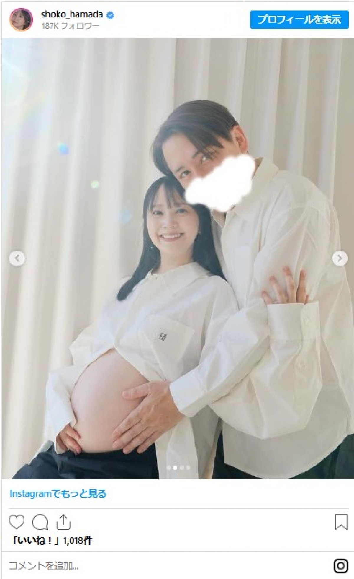 美女たちの幸せいっぱい“マタニティフォト”イッキ見　人気グラドルにフリーアナも