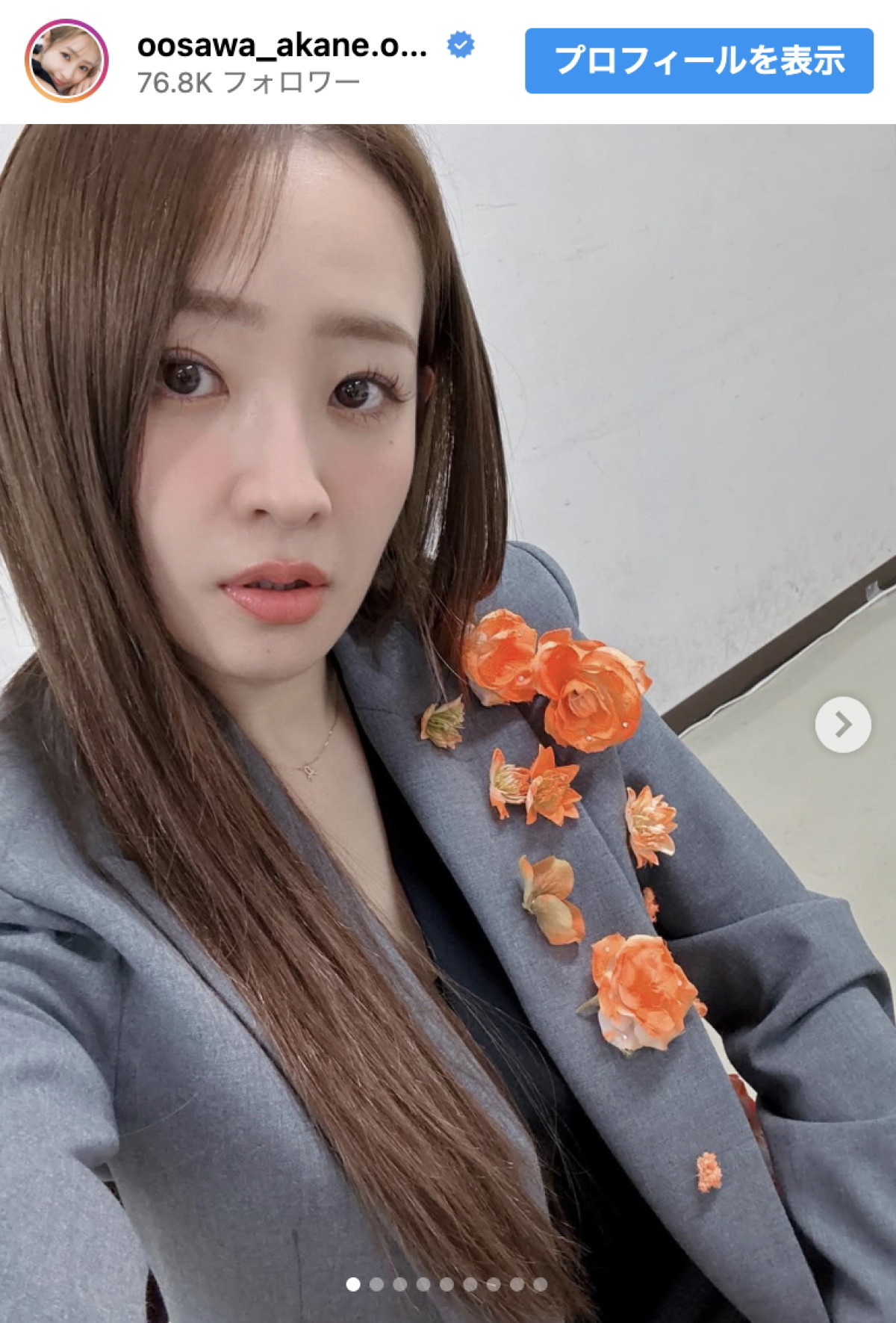 大沢あかね、『THE MUSIC DAY 2025』のオフショットを公開　※「大沢あかね」インスタグラム