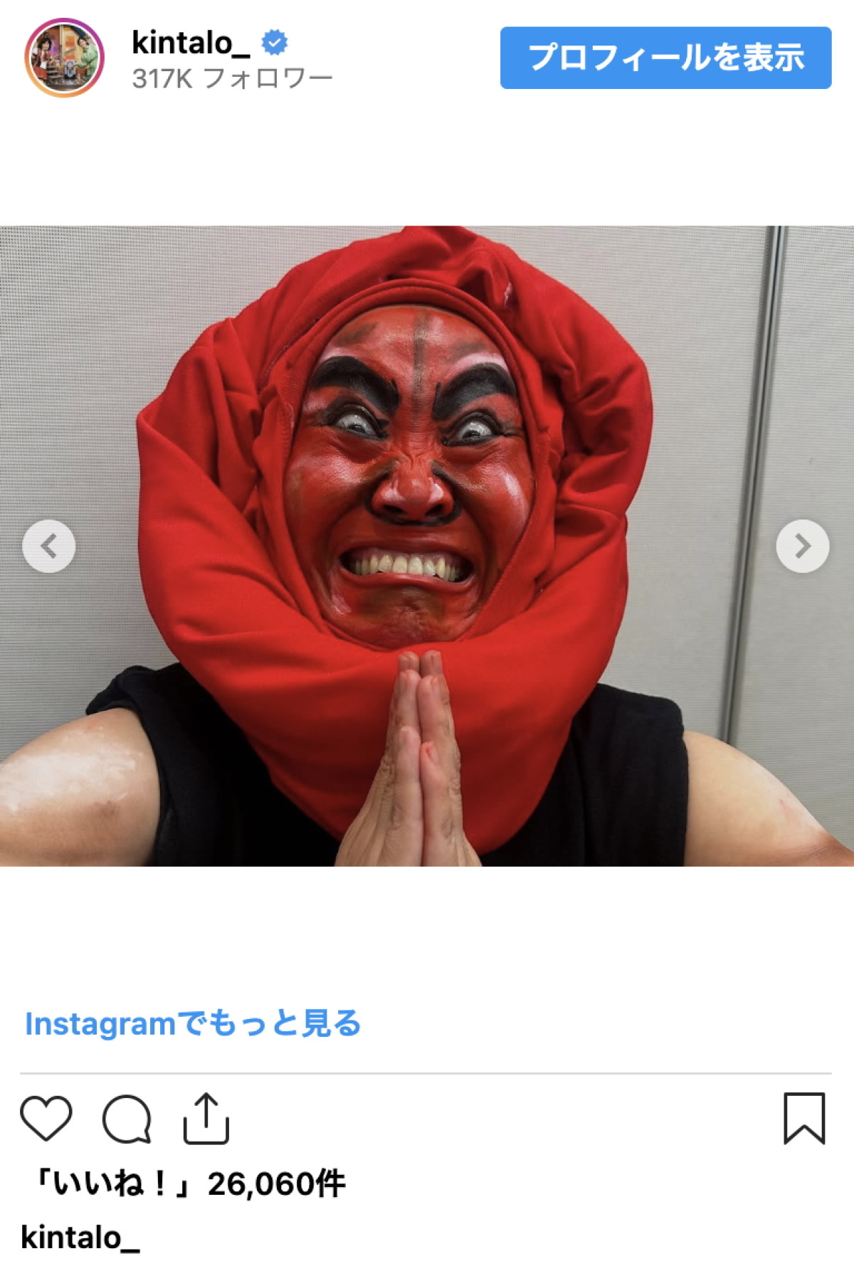 キンタロー。、インパクト抜群の“男梅姿”に反響「なんでこれができるんだ」「本当に天才」