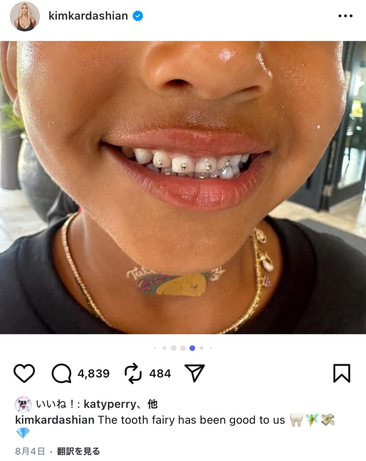 キム・カーダシアン、息子の乳歯が初めて抜けた時のお祝いが桁違い