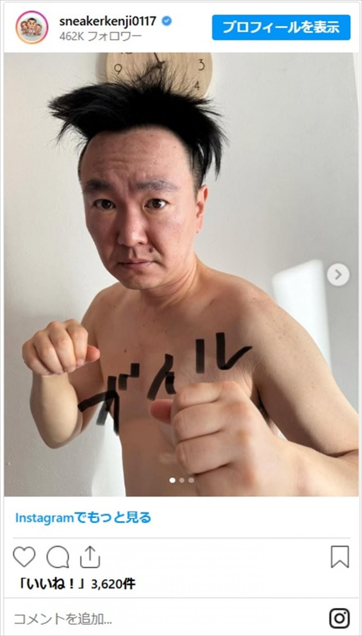かまいたち山内、寝ぐせでヘアスタイルが“ガイル”に「なぜ裸で!?」「44歳になったスネ夫みたい」