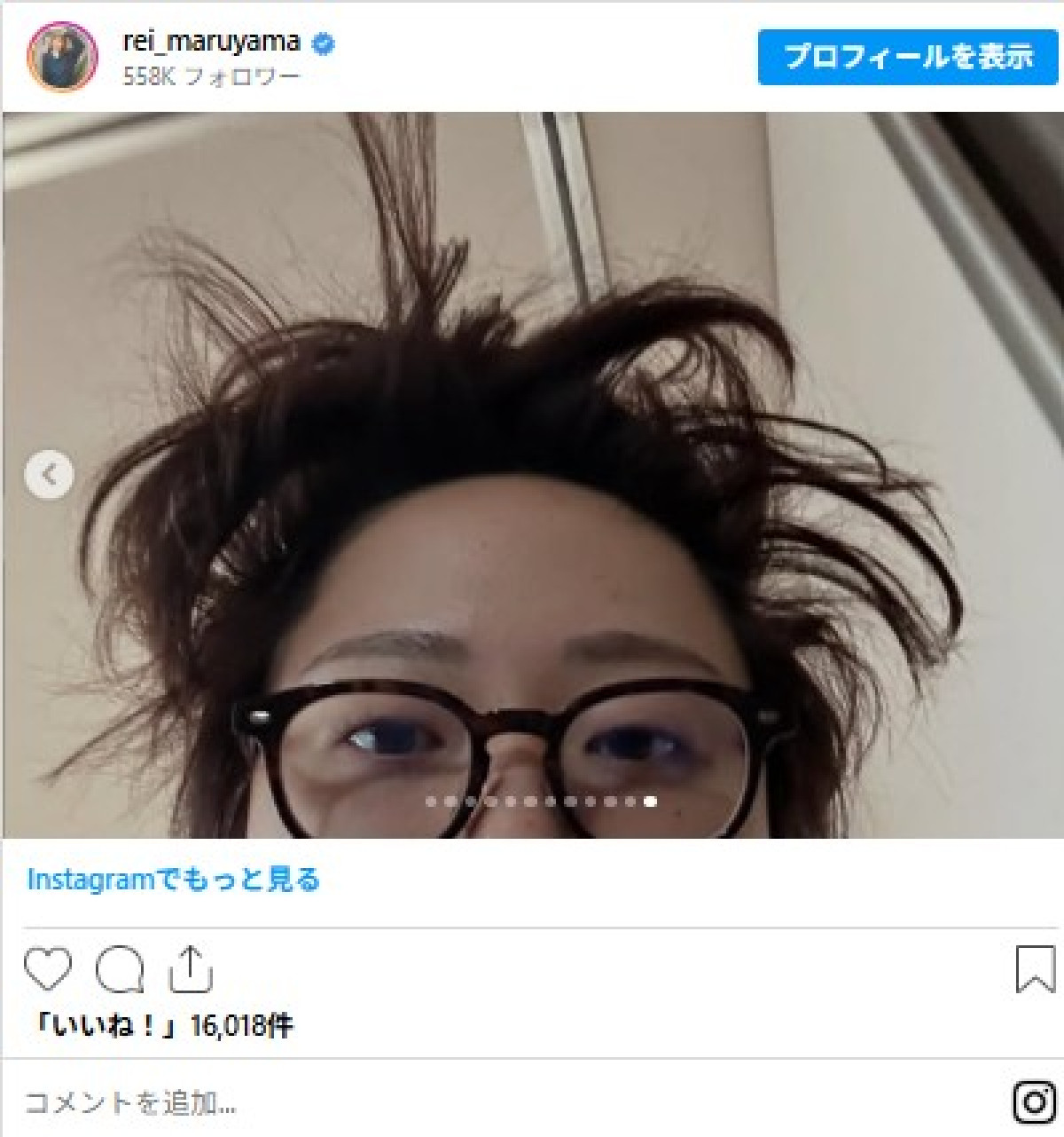 人気芸能人「寝ぐせヘア」コレクション　ストファイ「ガイル」風から生け花風まで！