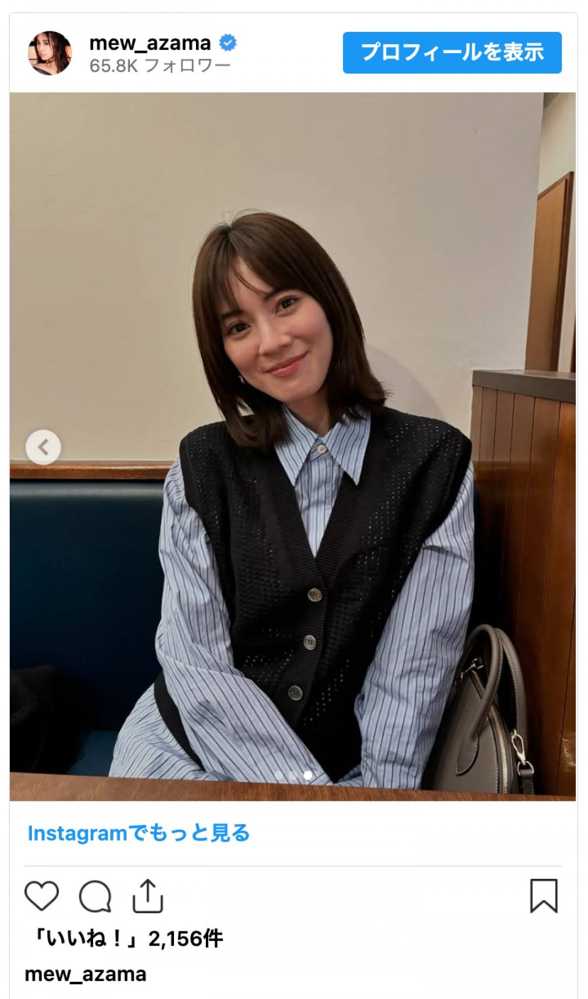 「燃え上がった」モデル・安座間美優、アクシデントでニューヘアに　かわいいけれど「お怪我なくてよかった」