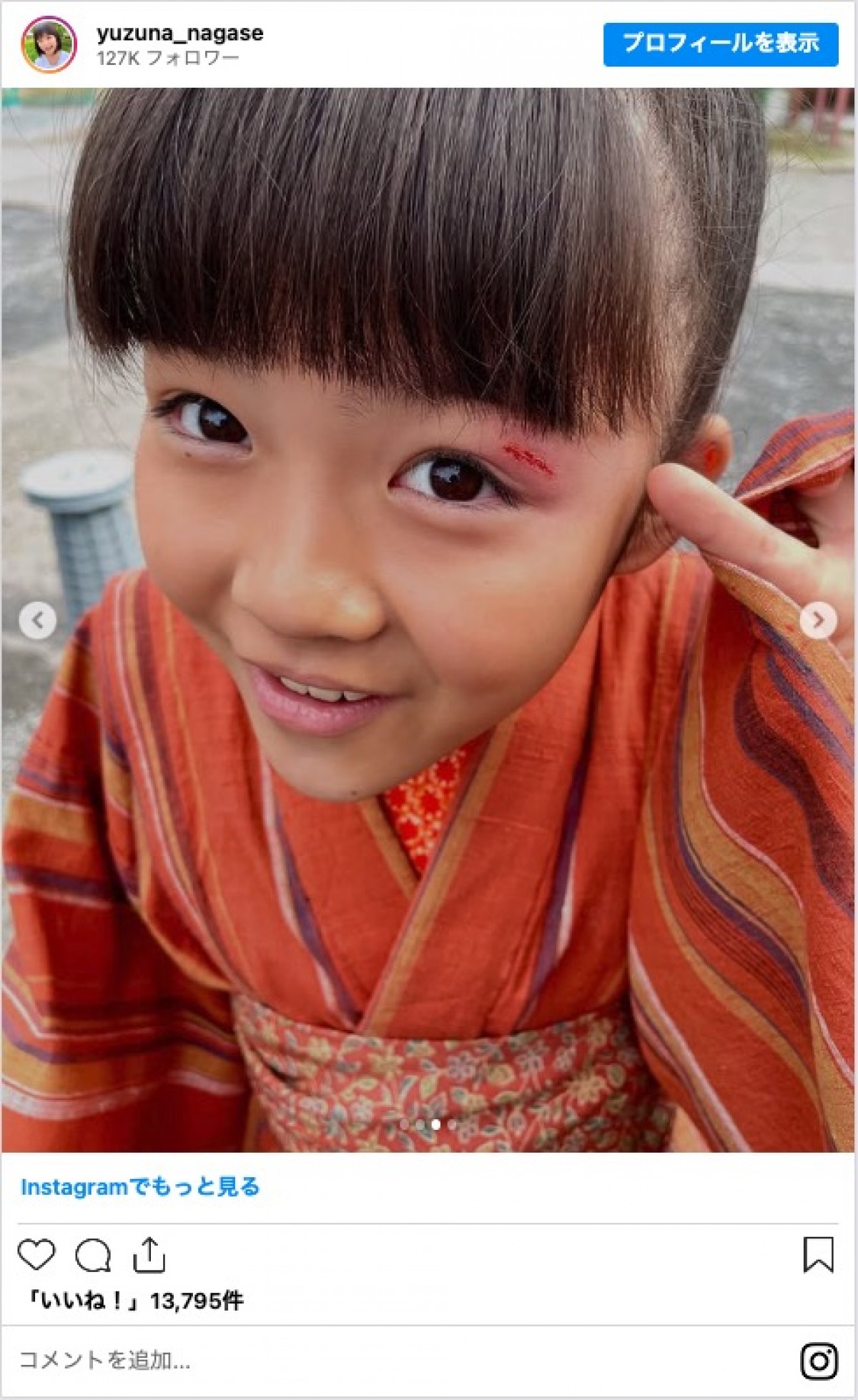『あんぱん』子役・永瀬ゆずなに感謝と労いの声続々「2週間お疲れ様」「後半、また出ないかな」