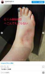 第1子妊娠中の中川翔子、“最近の悩み”を明かす　※「中川翔子」インスタグラム