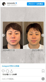 井上裕介、頭蓋骨マッサージの効果を披露　※「井上裕介（NON STYLE）」インスタグラム