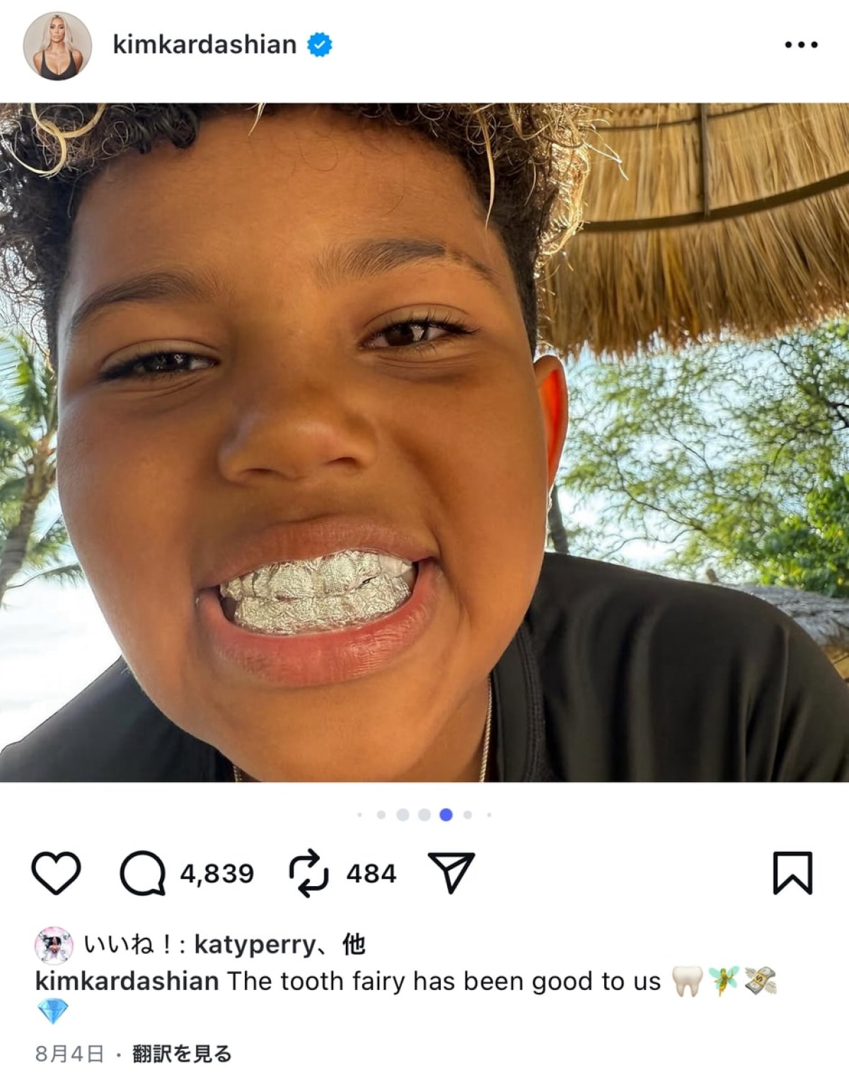 キム・カーダシアン、息子の乳歯が初めて抜けた時のお祝いが桁違い