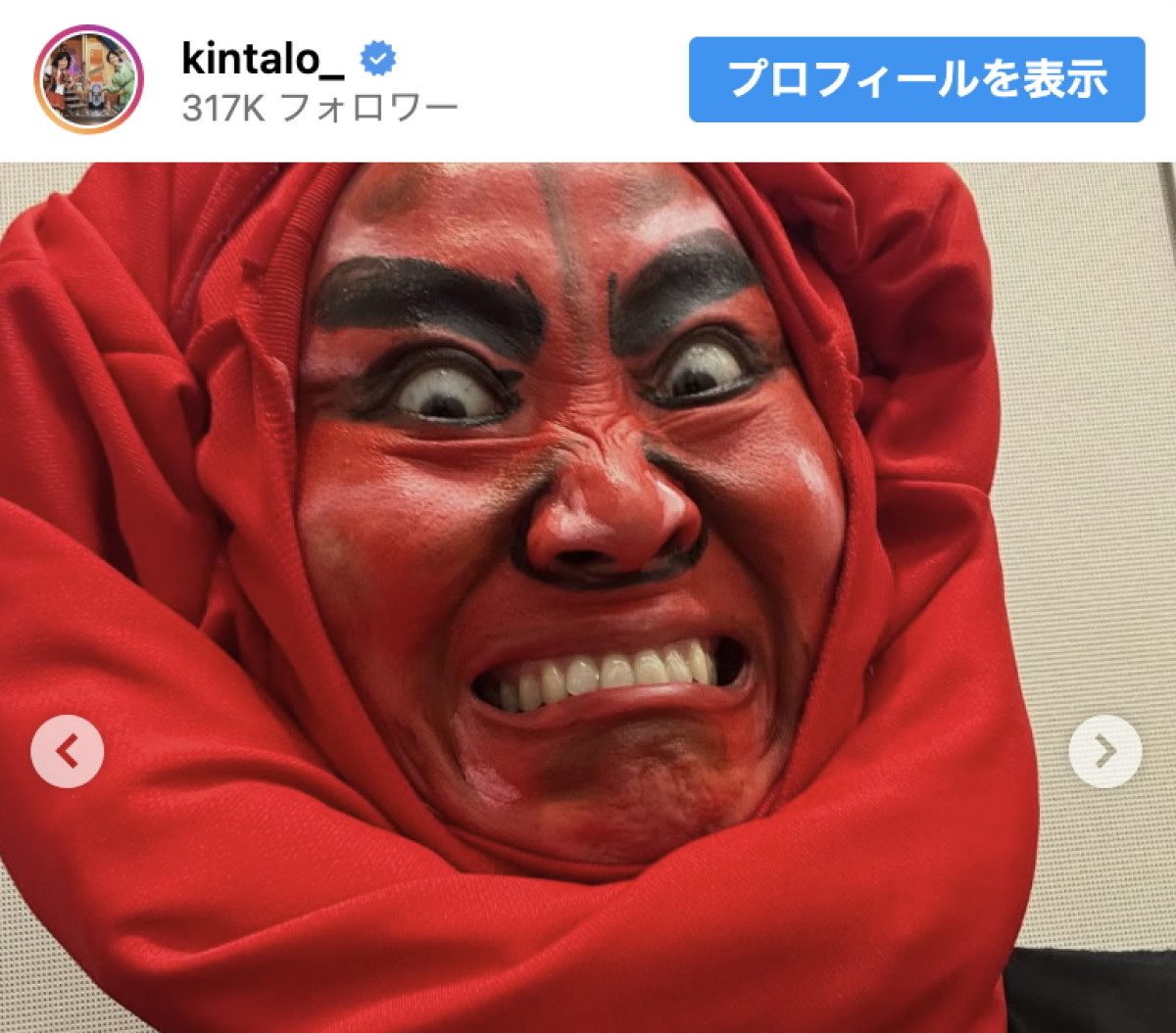 男梅(キンタロー。) ※「キンタロー。」インスタグラム
