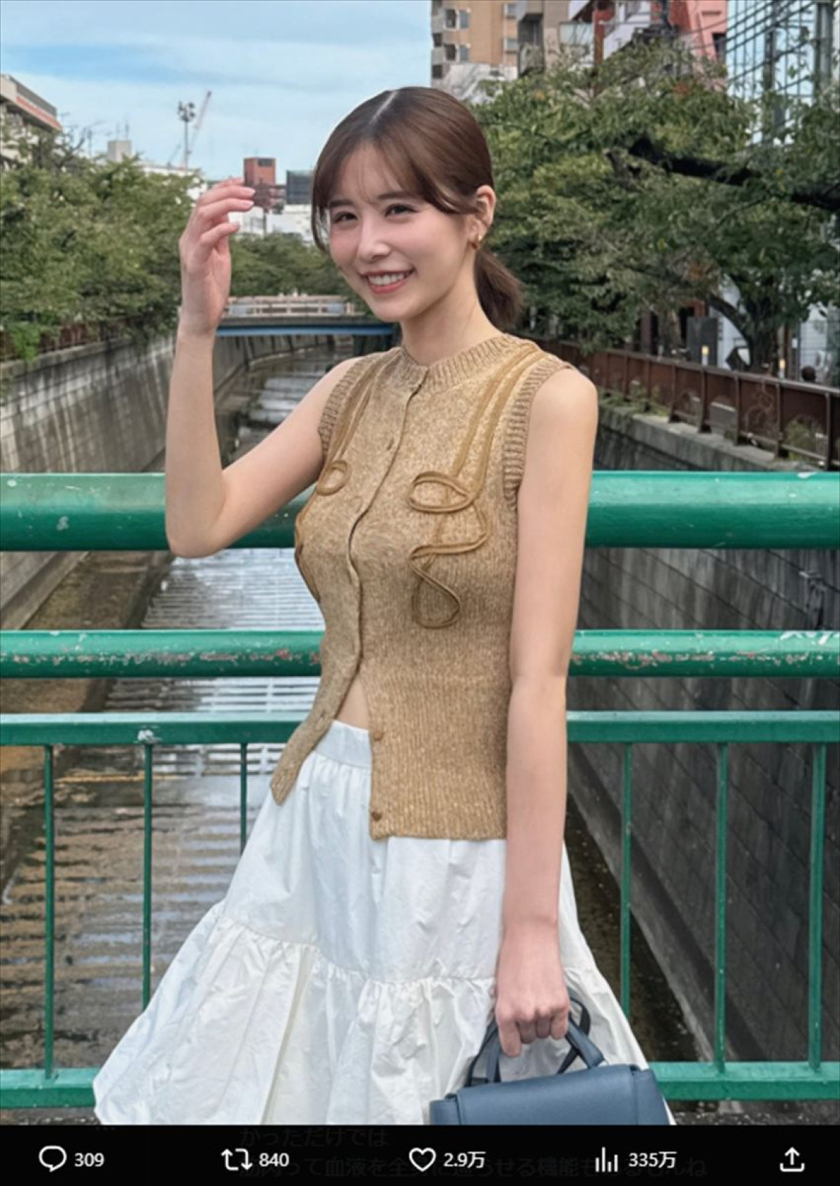 「1年かけて約10kg減量しました」　有村藍里35歳、ビフォーアフターに称賛の声「めっちゃスゴイ」「素敵」