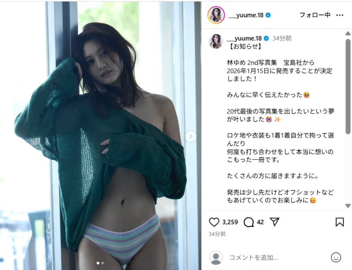 “世界で最も美しい顔100人”林ゆめ「早く伝えたかった」　うれしい“お知らせ”に反響
