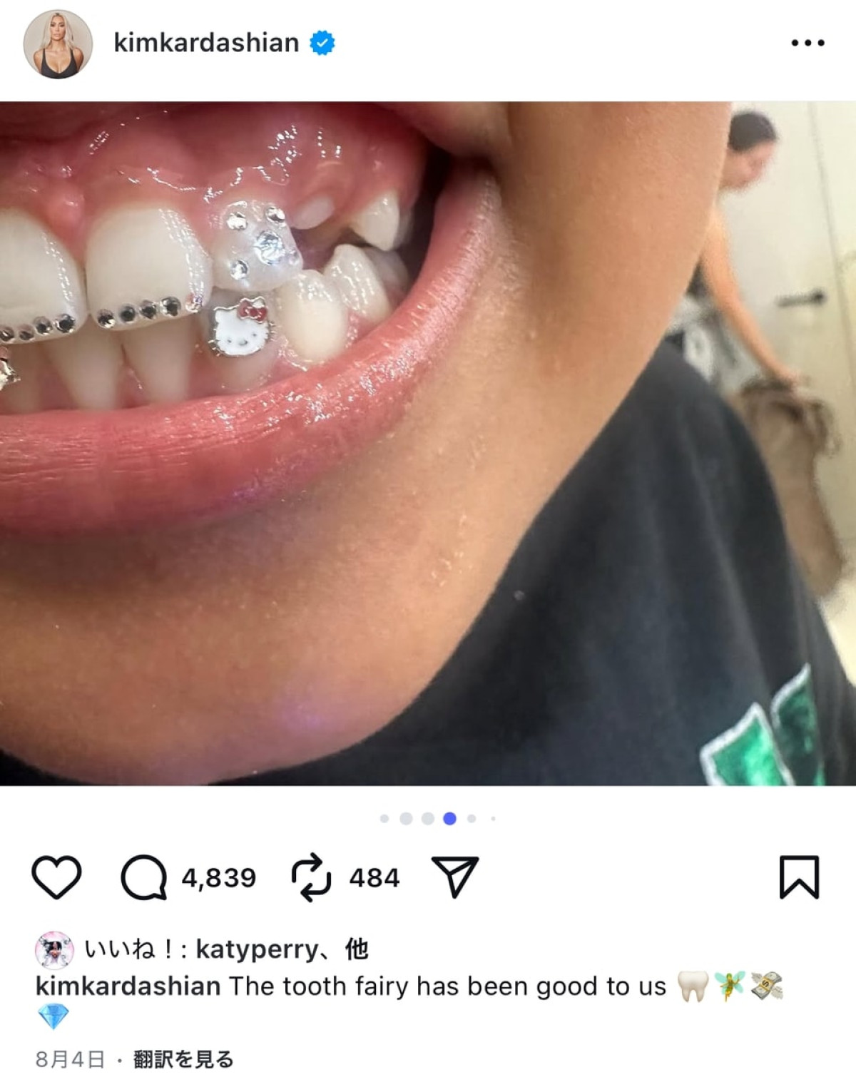 キム・カーダシアン、息子の乳歯が初めて抜けた時のお祝いが桁違い