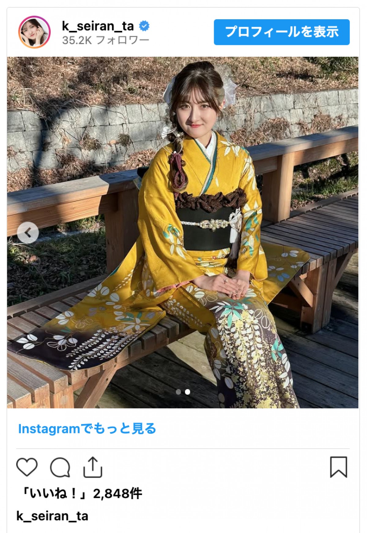 元子役・小林星蘭、成人式の振り袖姿披露「時が経つのが早すぎる」と話題