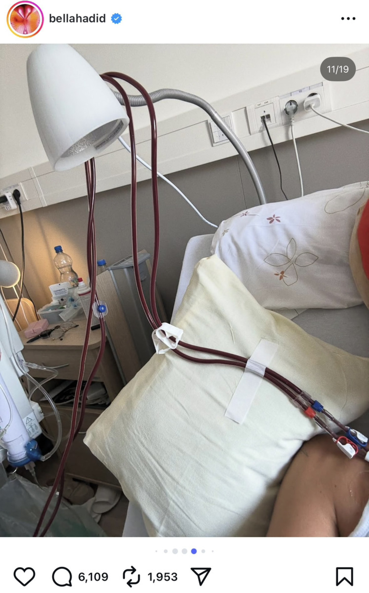 ベラ・ハディッドが入院中の写真を投稿　ファンから声援やお見舞いの声