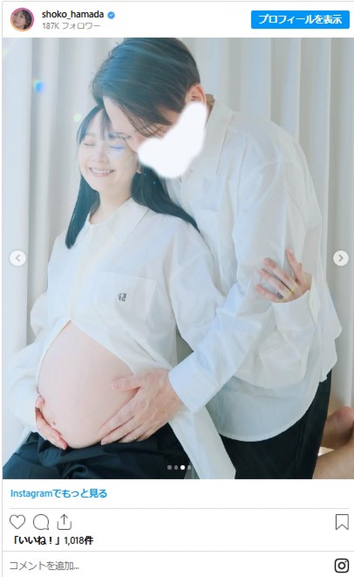 美女たちの幸せいっぱい“マタニティフォト”イッキ見　人気グラドルにフリーアナも