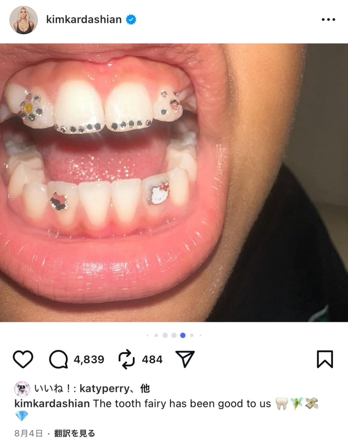 キム・カーダシアン、息子の乳歯が初めて抜けた時のお祝いが桁違い