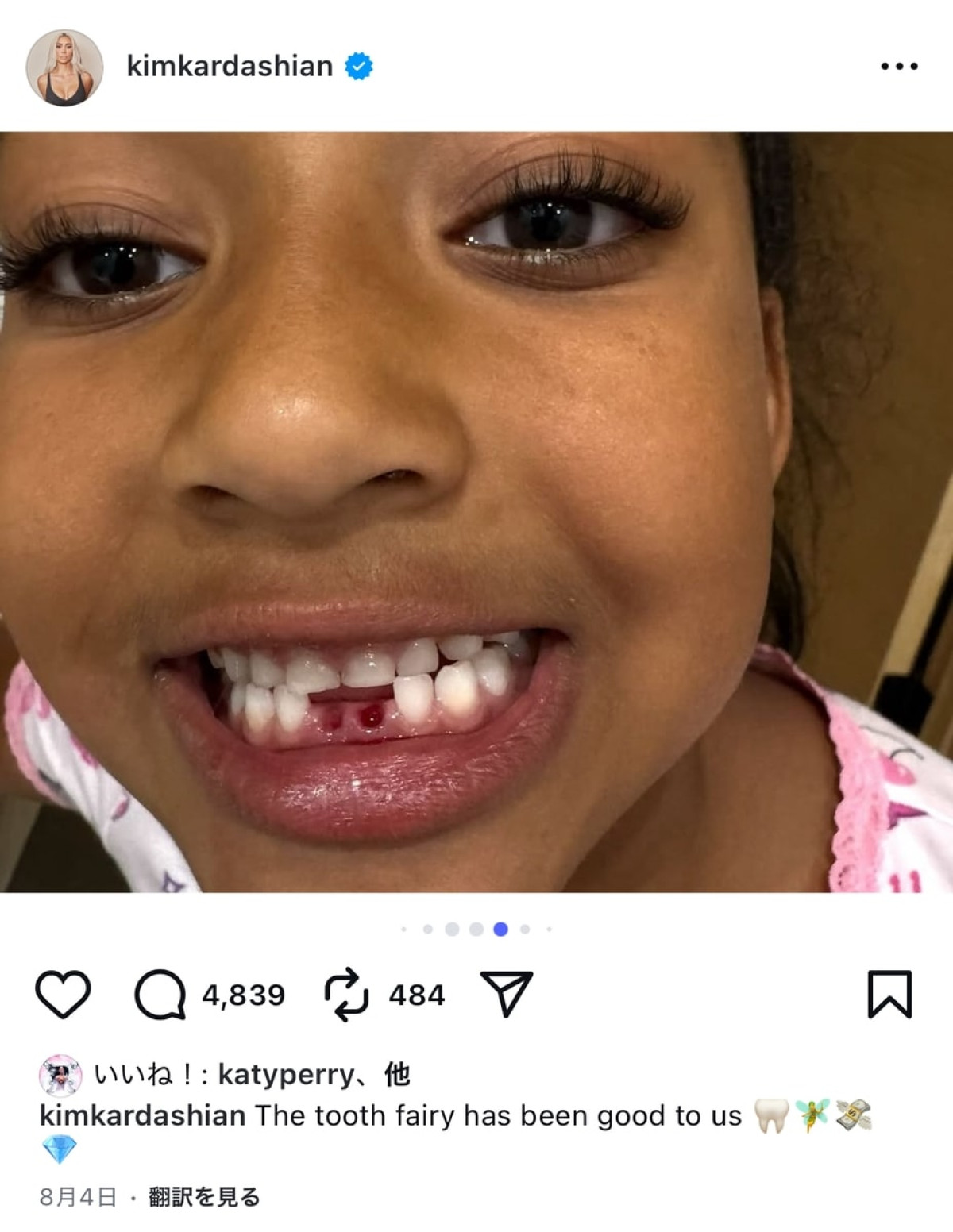 キム・カーダシアン、息子の乳歯が初めて抜けた時のお祝いが桁違い