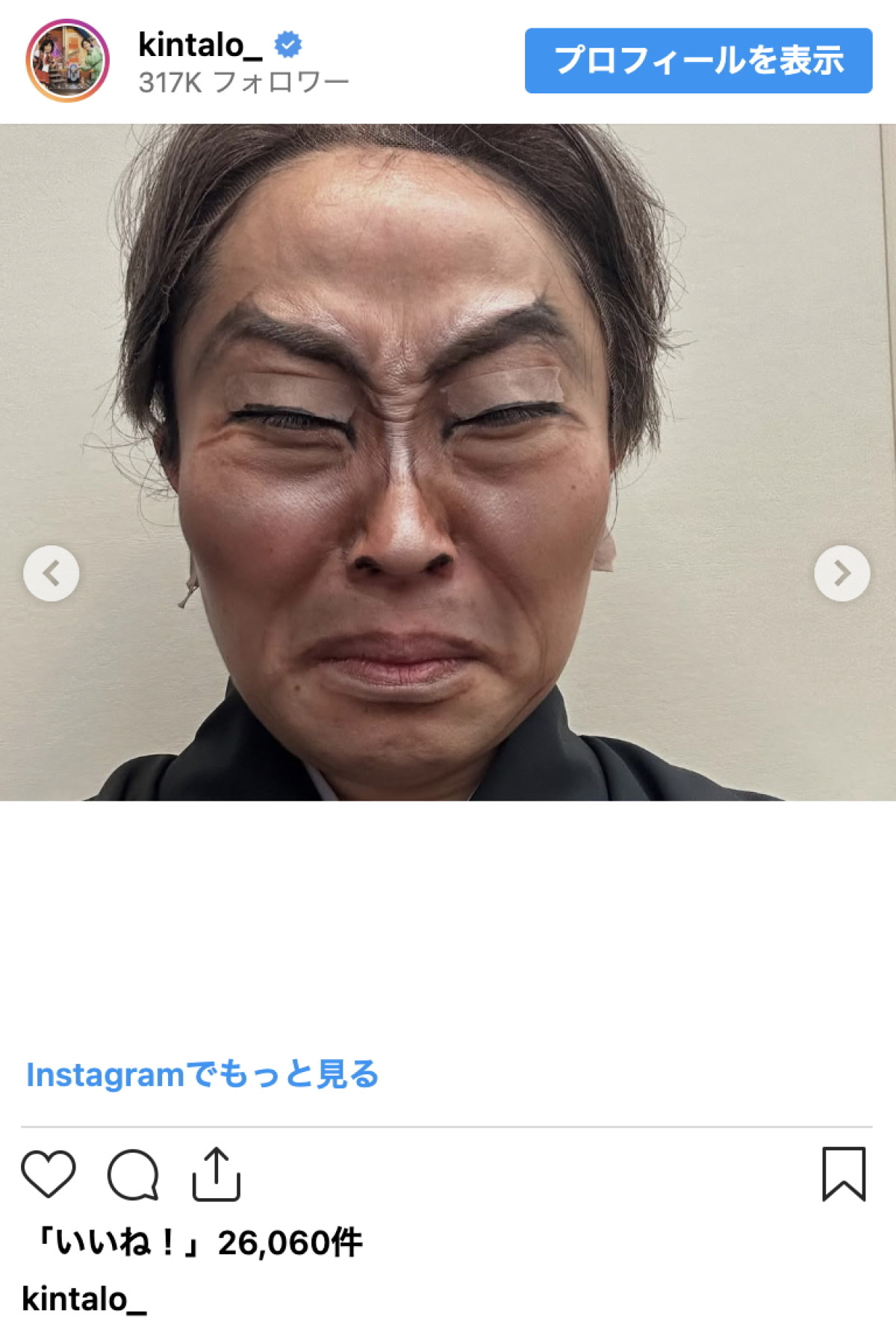 キンタロー。、インパクト抜群の“男梅姿”に反響「なんでこれができるんだ」「本当に天才」
