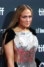 離婚発表直後のレッドカーペットではメイクで隠していた（2024年9月）