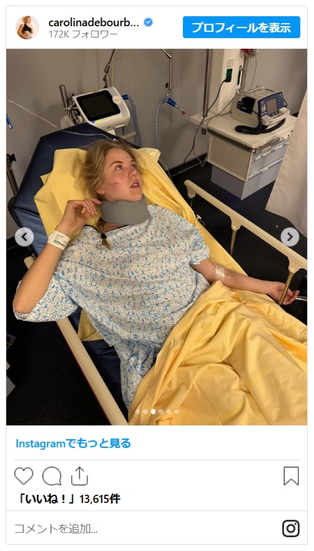 イタリアのマリア・カロリーナ王女、バイクで頭から壁に衝突する大事故「命があって幸運」