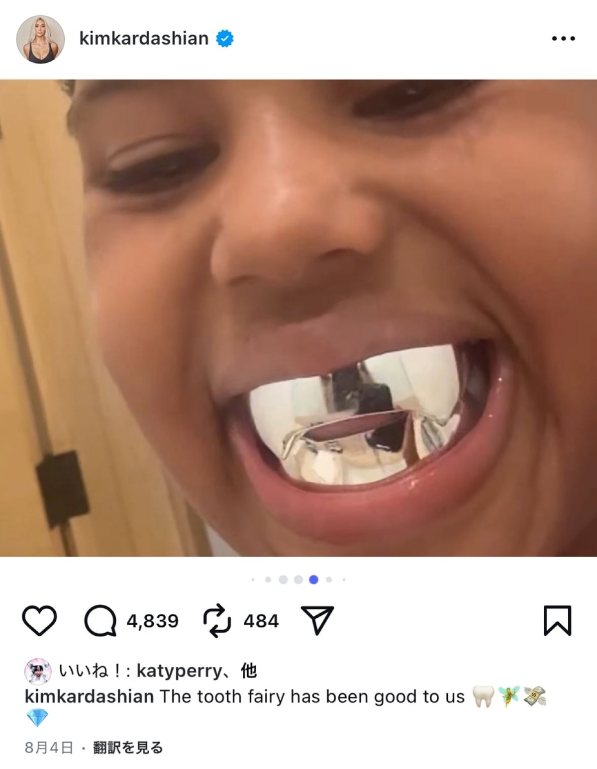 キム・カーダシアン、息子の乳歯が初めて抜けた時のお祝いが桁違い