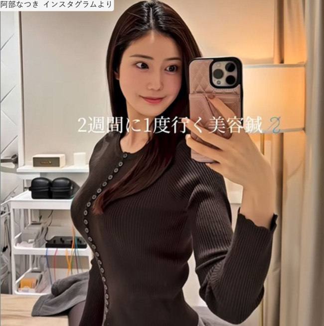 阿部なつき、ソロショット　※「阿部なつき」インスタグラム