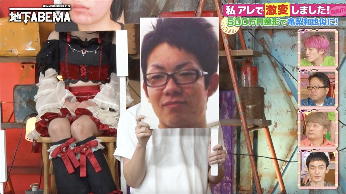 整形総額500万円で亀梨和也似イケメンに激変　鼻だけはイジらなかった理由