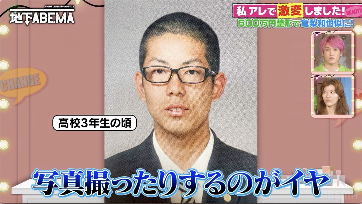 整形総額500万円で亀梨和也似イケメンに激変　鼻だけはイジらなかった理由