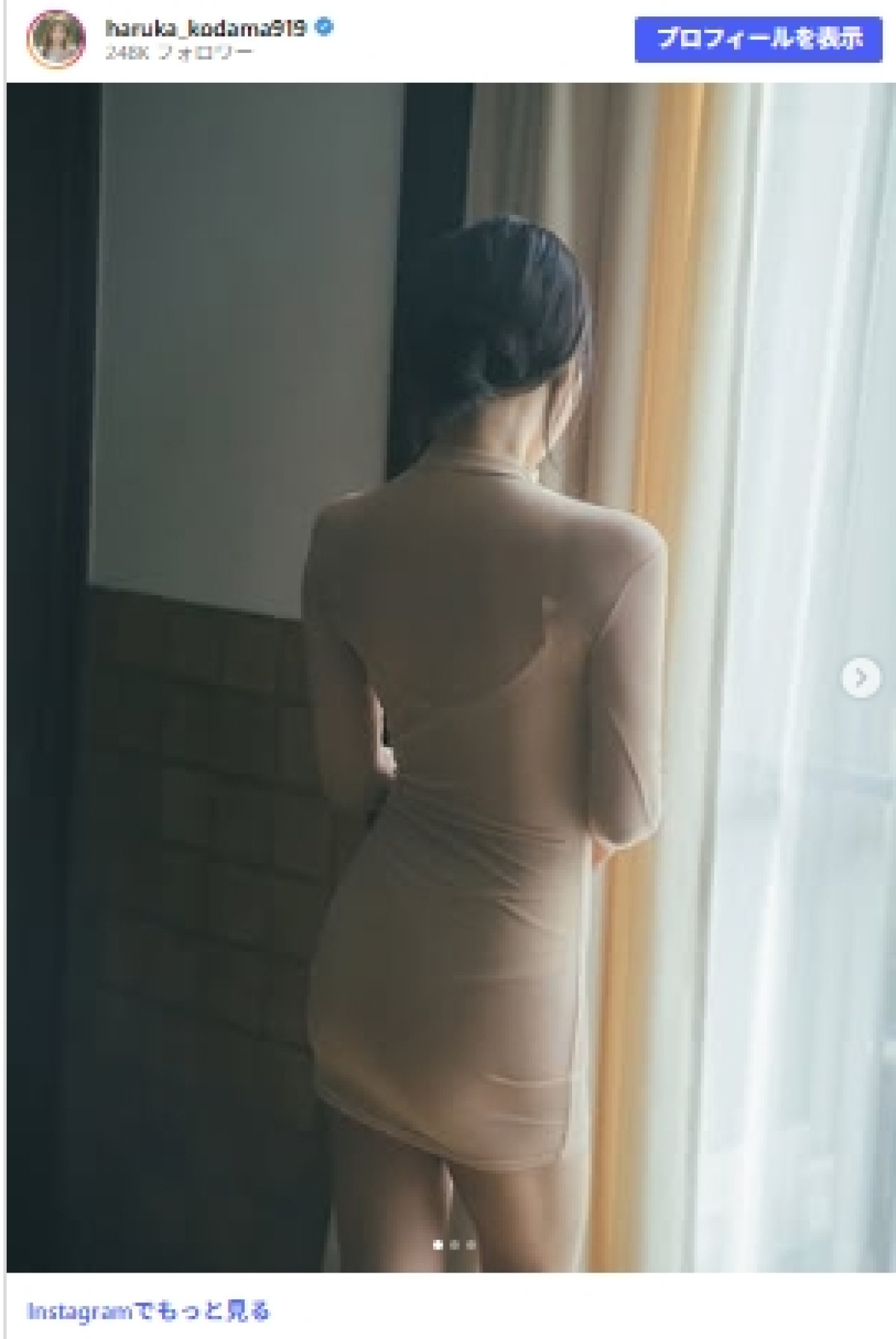 “整形総額1000万円超”元アイドル、『ダウンタイム』出演報告にファン驚き「え、気づかなかった」「よく見たらいる笑」