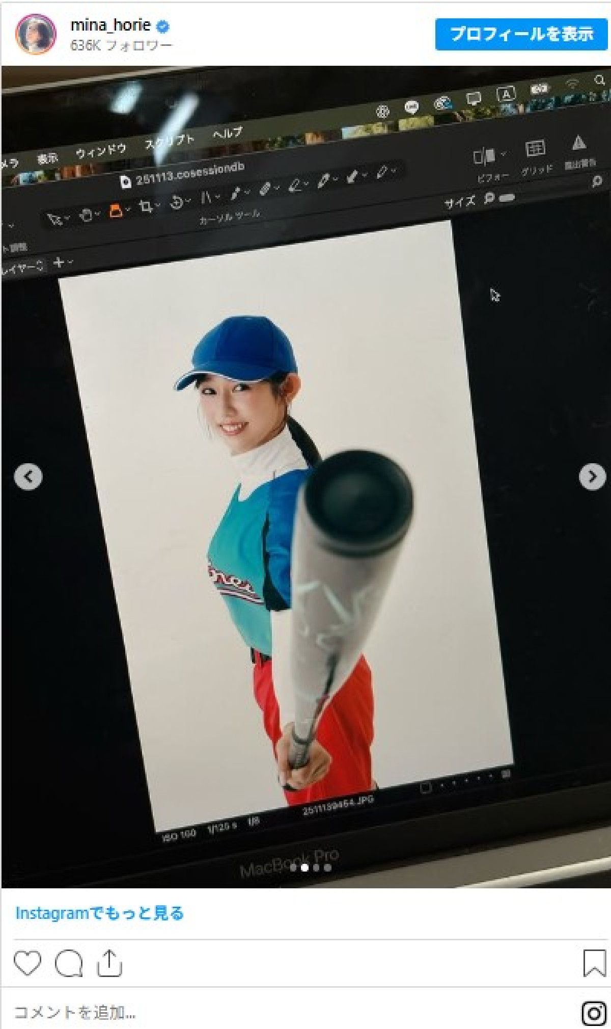 “日本一強いアナウンサー”の美女、短パンで太ももあらわの“ベースボールルック”に反響