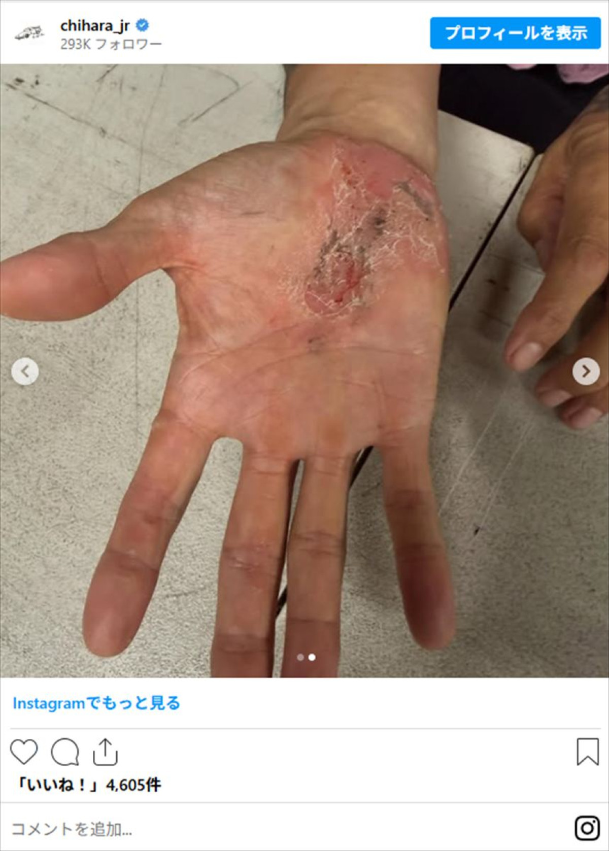 千原ジュニア、“伝説的ドラマー”の楽屋訪問　プレイの激しさ物語る写真に驚き