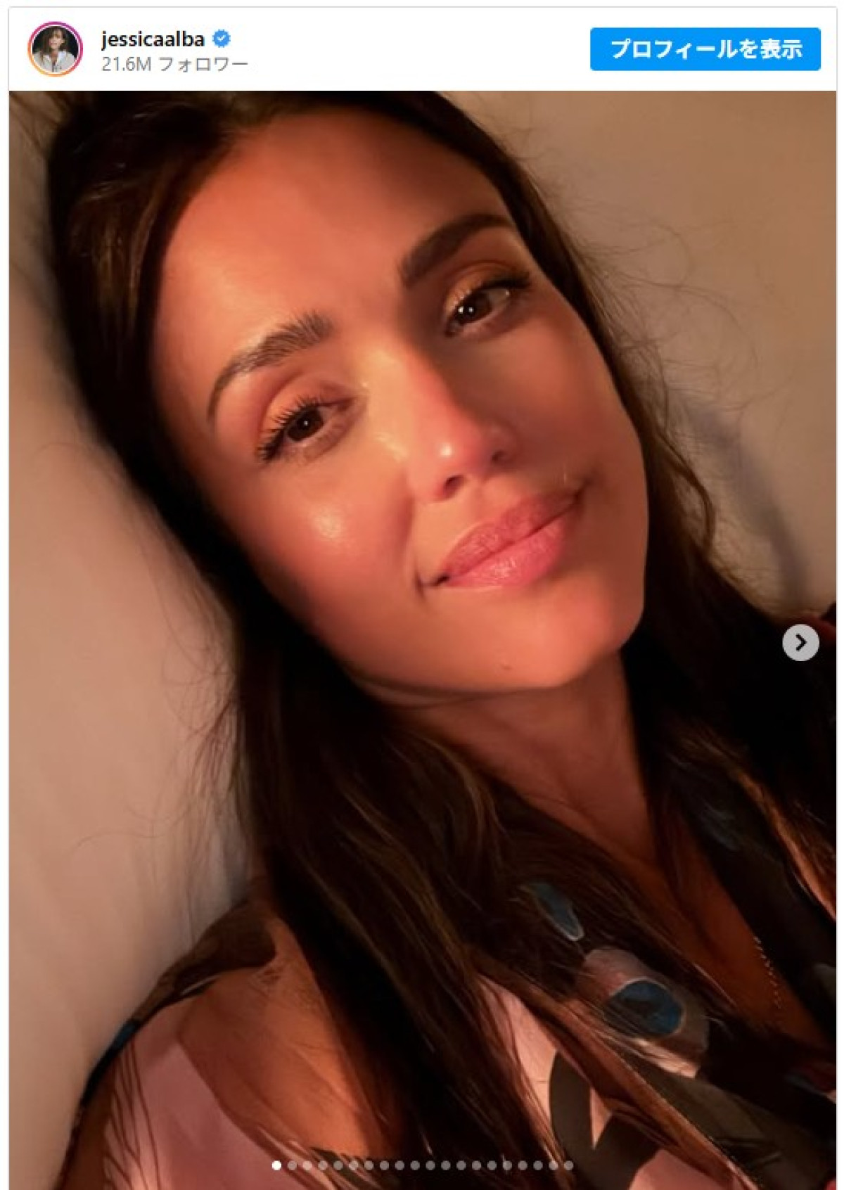 ジェシカ・アルバの11歳年下恋人、“ラブラブ”バカンス写真を披露