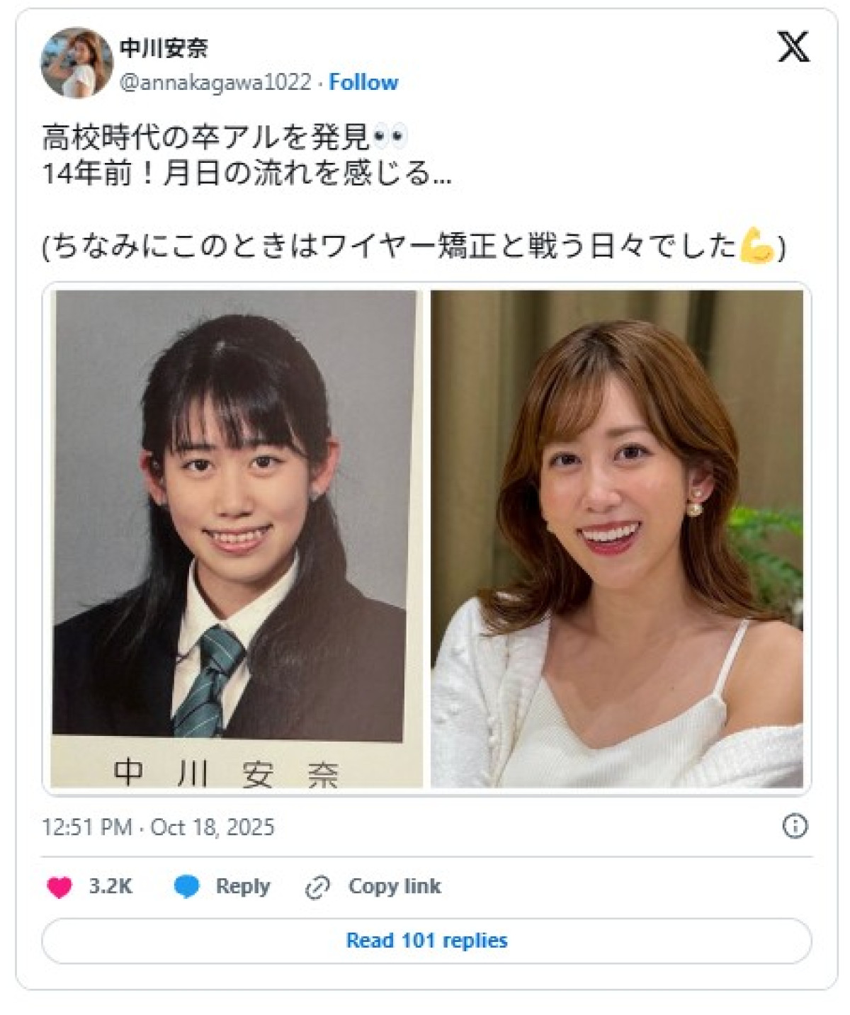 芸能人の卒業アルバムに驚き！　元NHKアナの14年前、ギャル芸人の清楚時代、ネオ昭和アイドルの平成時代も