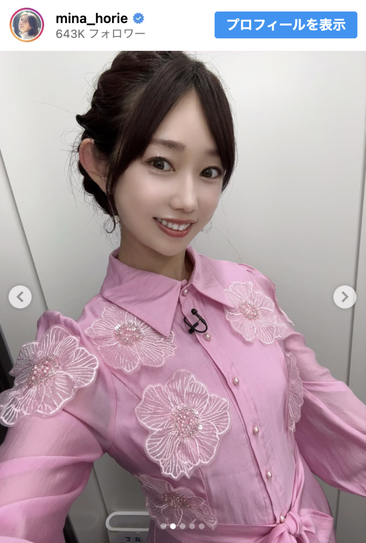 骨折中の“日本一強いアナウンサー”美女、かわいらしいピンクワンピース姿を公開