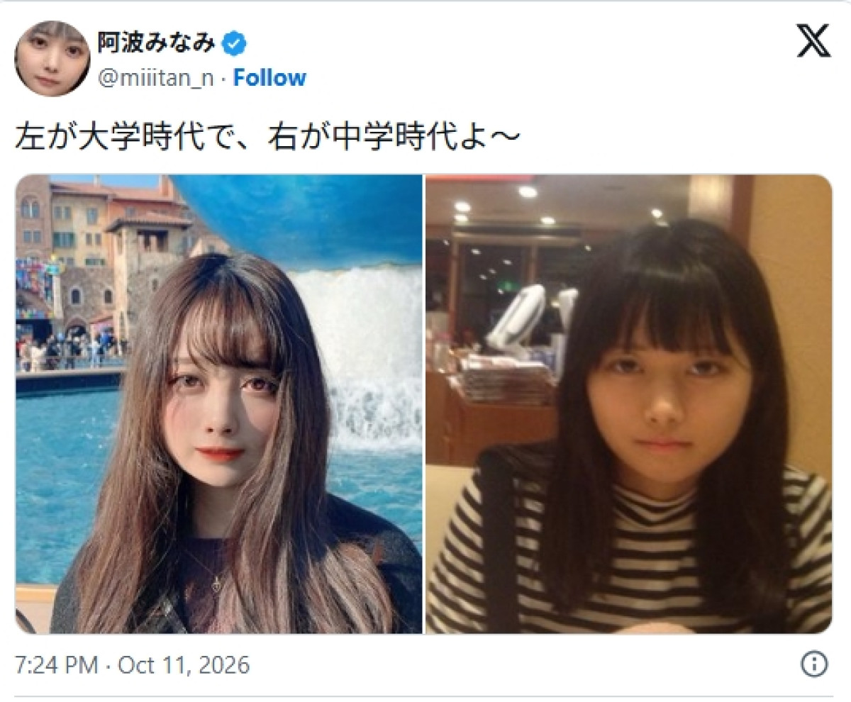 「別人すぎる」「AIかと思った」「美人」　令和のドラえもん・タレント29歳、“大学＆中学生時代”の衝撃ビフォアフにファン驚がく
