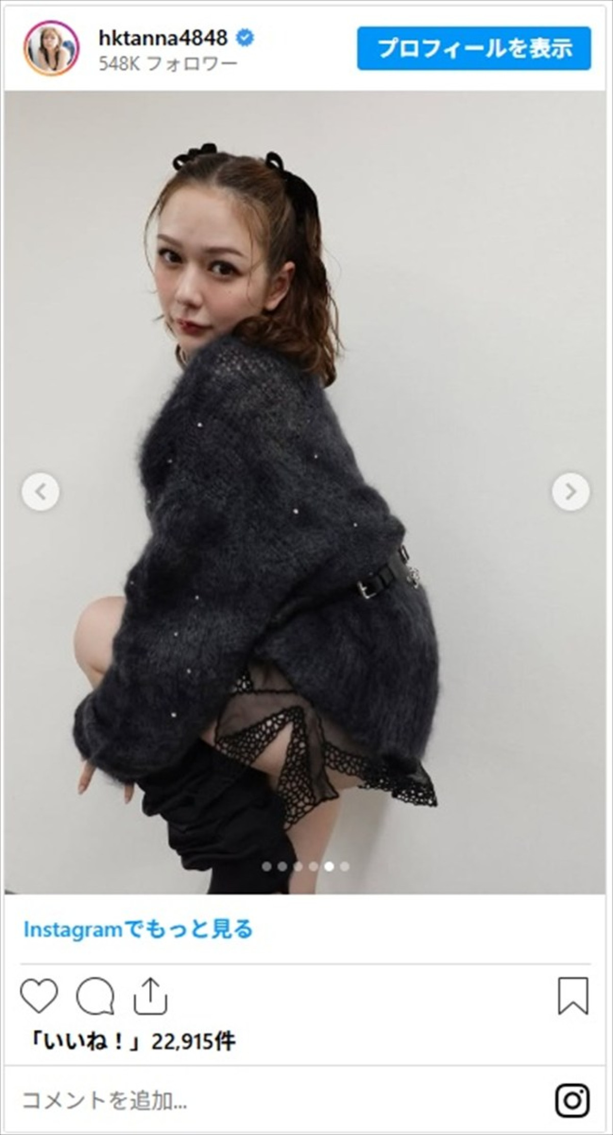 美女が髪バッサリ切って印象激変！　大ブレイクバラドルは“人生最短ショート”に