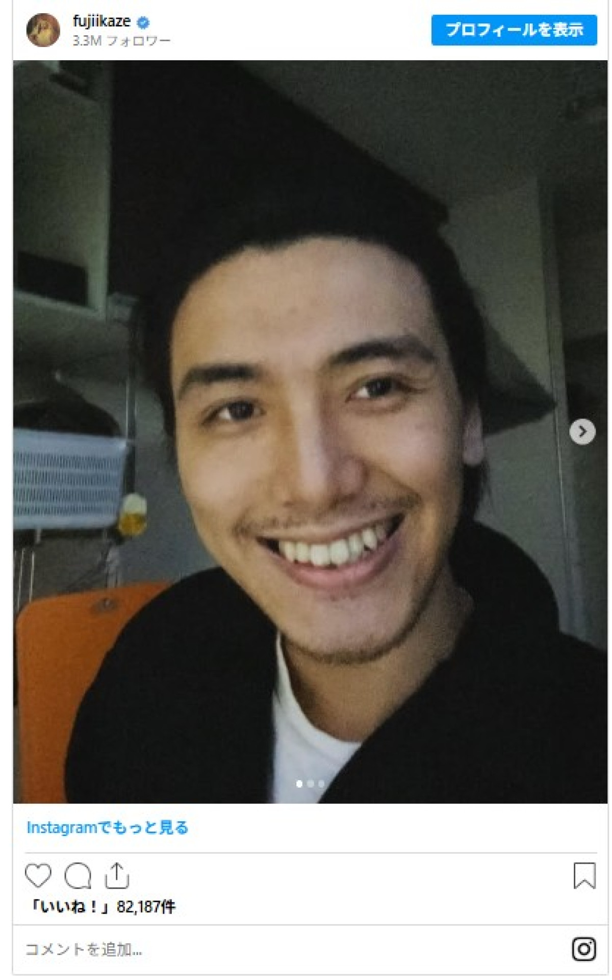 歯列矯正した芸能人ビフォーアフター！　矯正器具つけたまま『紅白』出た人気歌手に“口元排水溝”芸人も