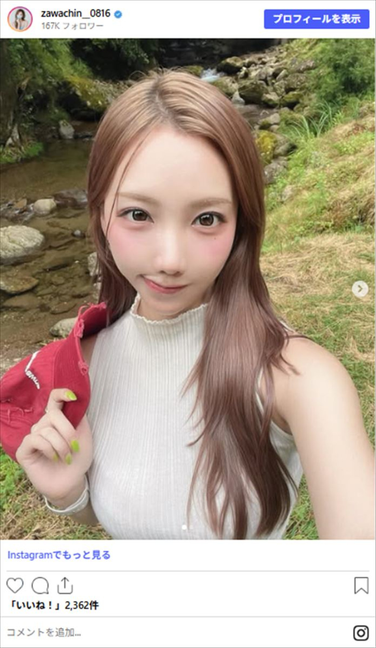 ざわちん、整形「1週間前にした」　ビフォーアフター公開
