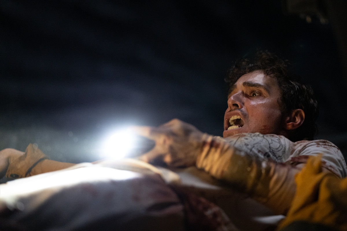 “離れるため”に血みどろになっていく『トゥギャザー』場面写真解禁 「体を密着させたままトイレに」過酷な撮影エピソードも