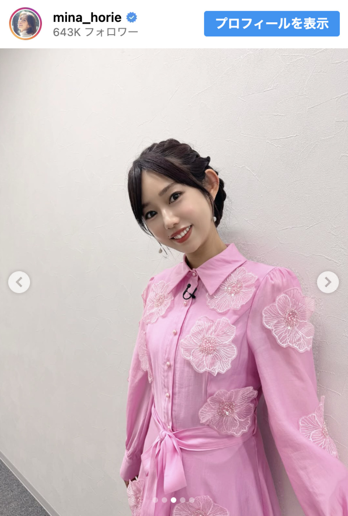 骨折中の“日本一強いアナウンサー”美女、かわいらしいピンクワンピース姿を公開